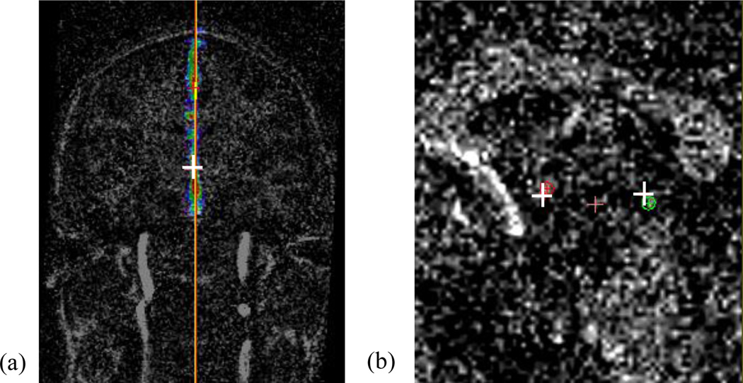 Fig. 18