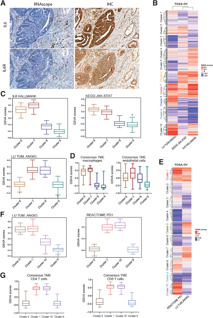 Figure 6. Clustering of TCGA dataset based on angiogenesis, IL6, and PD-1 pathway expression. A, RNAscope and IHC for IL6 and IL6R in HGSOC patient biopsies B. Heatmap illustrates GSVA enrichment scores for Lu tumor angiogenesis up, Kegg JAK-STAT signaling pathway, and Hallmark IL6-JAK-STAT signaling from MSigDB calculated for each sample of the TCGA ovarian dataset (n = 571). C, Boxplots illustrate GSVA scores for Lu tumor angiogenesis up, Kegg JAK-STAT signaling pathway, and Hallmark IL6-JAK-STAT across clusters 6, 7, 8, and 9 representing four major patterns of pathways’ expression (n = 57, 65, 38, 79 respectively). D, ConsensusTME applied on sample clusters identified in (B). Boxplots illustrate GSVA scores for macrophages and endothelial cells across the four clusters of interest. E, Heatmap illustrates GSVA enrichment scores for Lu tumor angiogenesis up and Reactome PD-1 signaling calculated for each sample of TCGA ovarian dataset. F, Boxplots illustrate GSVA scores for Lu tumor angiogenesis up and Reactome PD-1 signaling across clusters 5, 1, 10, and 9 representing the four major expression patterns of these pathways (n = 46, 65, 76, 43 respectively). G, ConsensusTME was applied on the sample clusters identified in (E). Boxplots illustrate GSVA scores for CD4 and CD8 T cells across four clusters of interest.