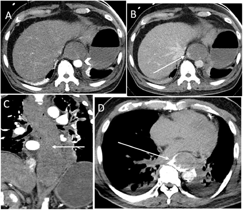 Fig. 1 –