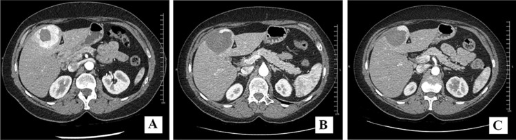 Fig. 1