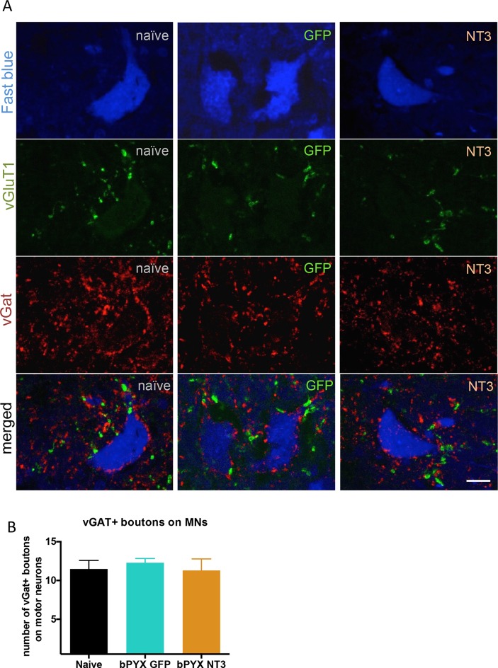 Figure 4—figure supplement 1.