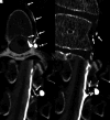 FIG 4.