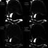 FIG 6.