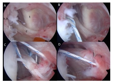 Fig. (14)