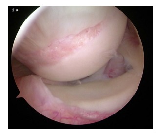 Fig. (12)