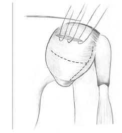 Fig. (9)