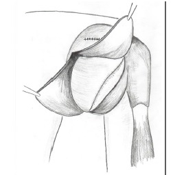Fig. (10)