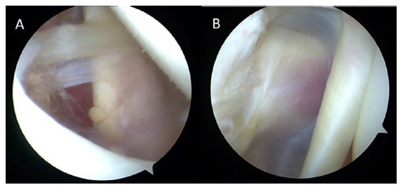 Fig. (13)