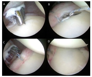Fig. (15)