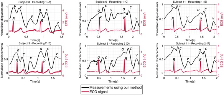 Figure 11