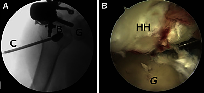 Fig 5