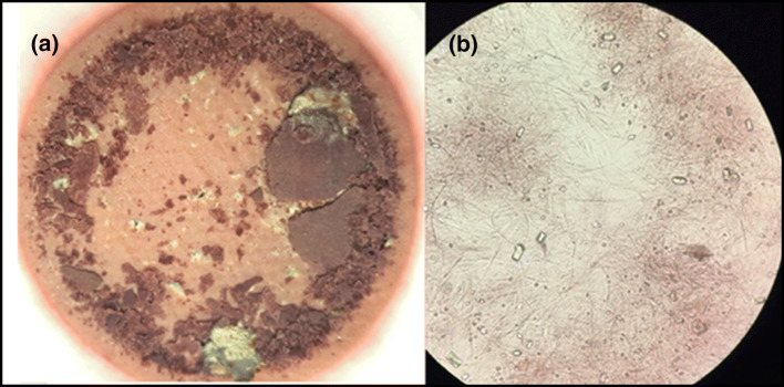 Fig. 1