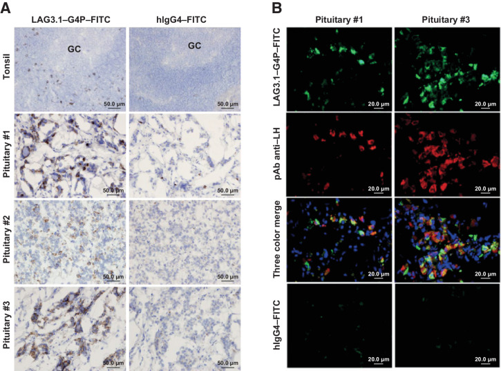 Figure 6. Binding of LAG3.1-G4P in the human pituitary gland. A, IHC of FITC-conjugated LAG-3.1-G4P (left) in positive control tissue (hyperplasia tonsil, n = 2) and normal human pituitary samples (n = 3). FITC-conjugated human IgG4 was used as isotype control (right). Counterstained with Mayer's hematoxylin. B, Colocalized binding of anti–LAG-3 antibody in LH-producing gonadotroph cells. Double immunofluorescent staining of FITC-conjugated LAG-3.1-G4P (green) and mouse mAb anti-LH (red) on cryostat sections from two normal human pituitary samples. FITC-conjugated human IgG4 and mouse IgG1 (not shown) were used as isotype controls (bottom) while nuclei were counterstained using Hoechst 33342. FITC, fluorescein isothiocyanate; GC, germinal center of the tonsil; LH, luteinizing hormone; mAb, monoclonal antibody.