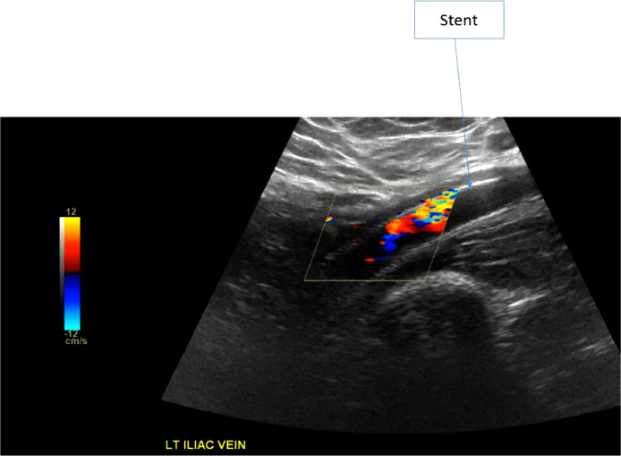 Fig 2: