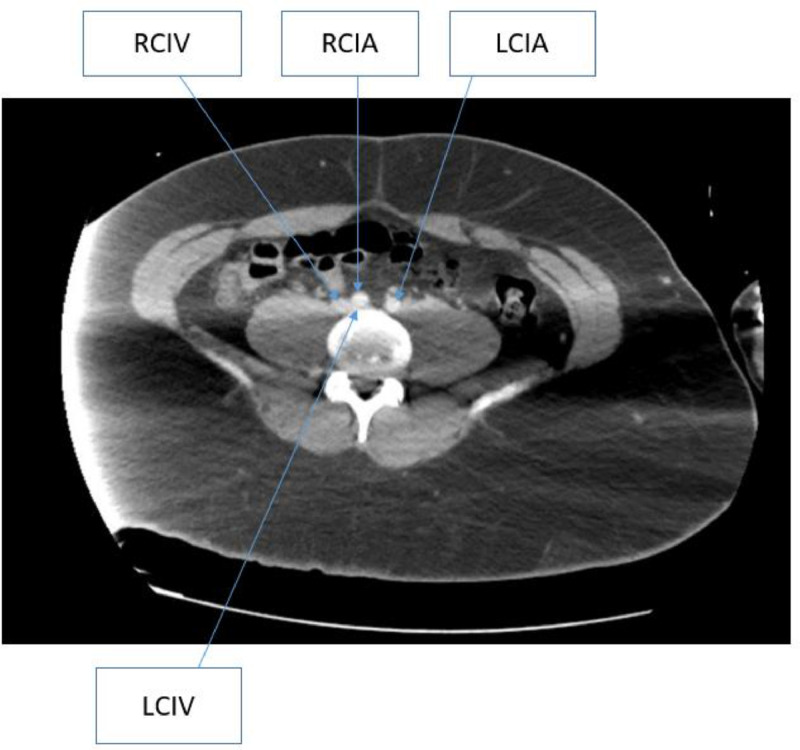 Fig 1: