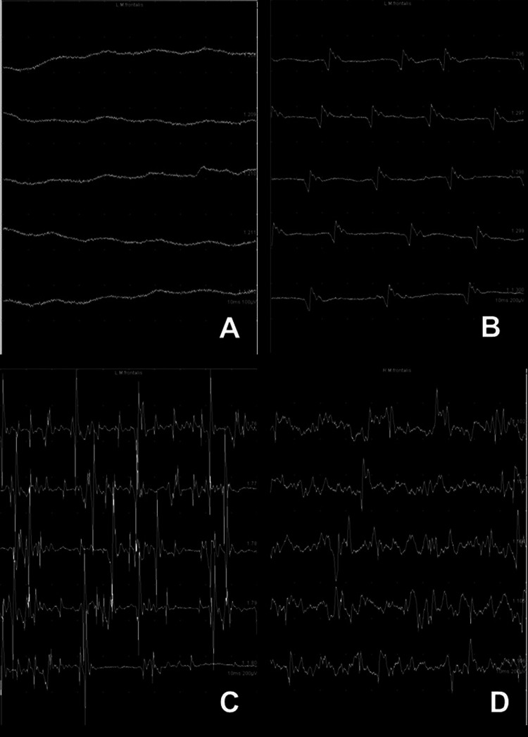 Fig. 4