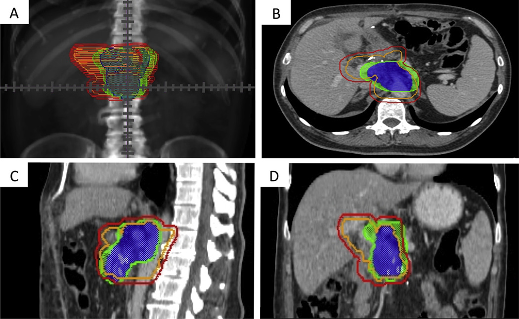 Fig. 4