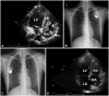 Fig. 3