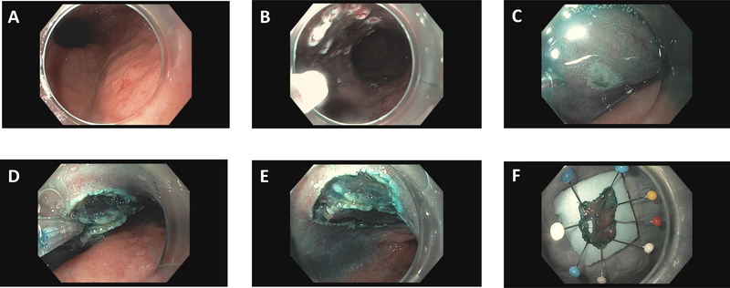 Figure 1: