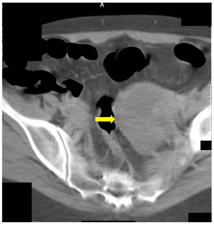 Figure 5