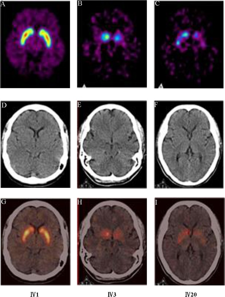 Fig 3