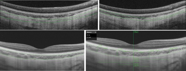 Fig. 2