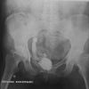 Fig. 1b