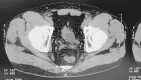 Fig. 3f