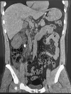 Fig. 3a