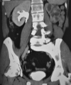Fig. 1a