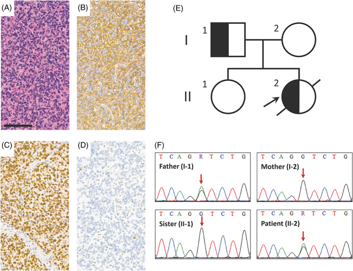 FIGURE 1