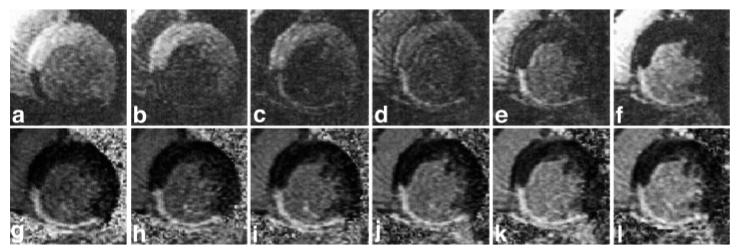 FIG. 7