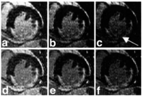 FIG. 9