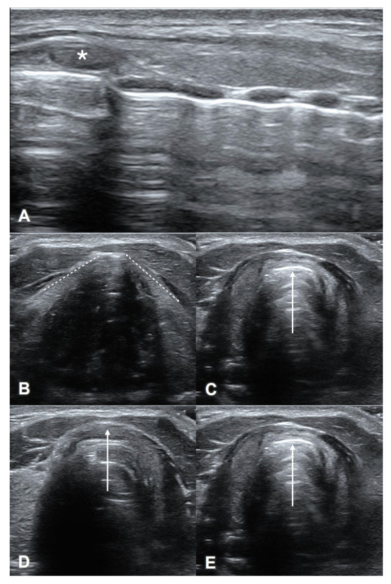 Figure 10