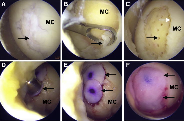 Fig 1