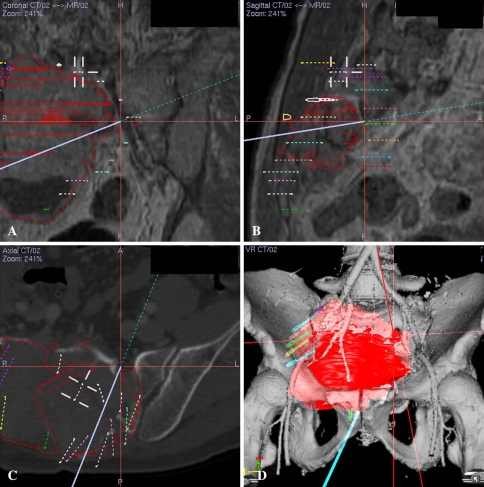 Fig. 3A–D