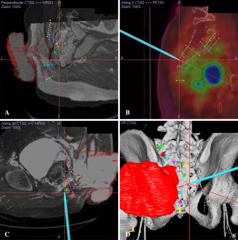 Fig. 4A–D