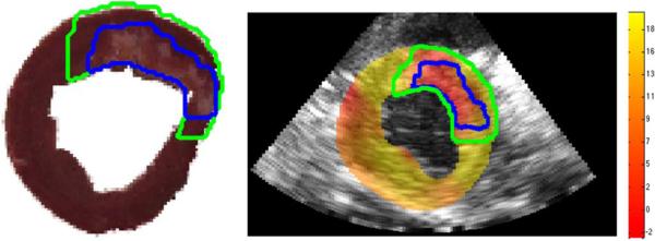 Fig. 11