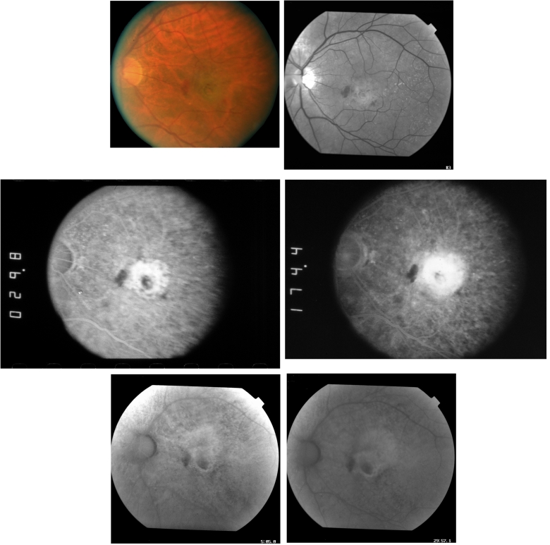 FIGURE 12