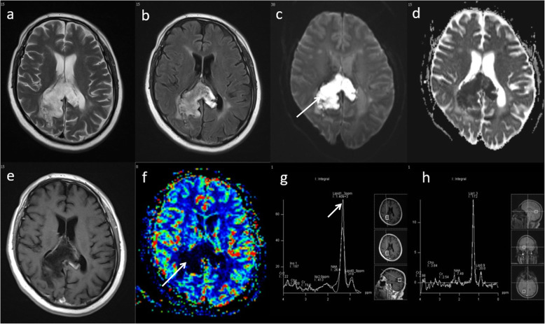 Fig. 17