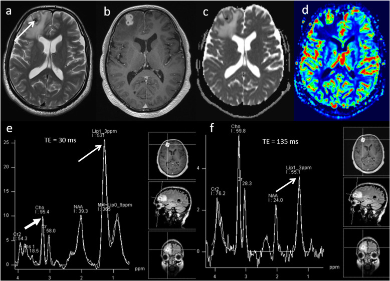 Fig. 13