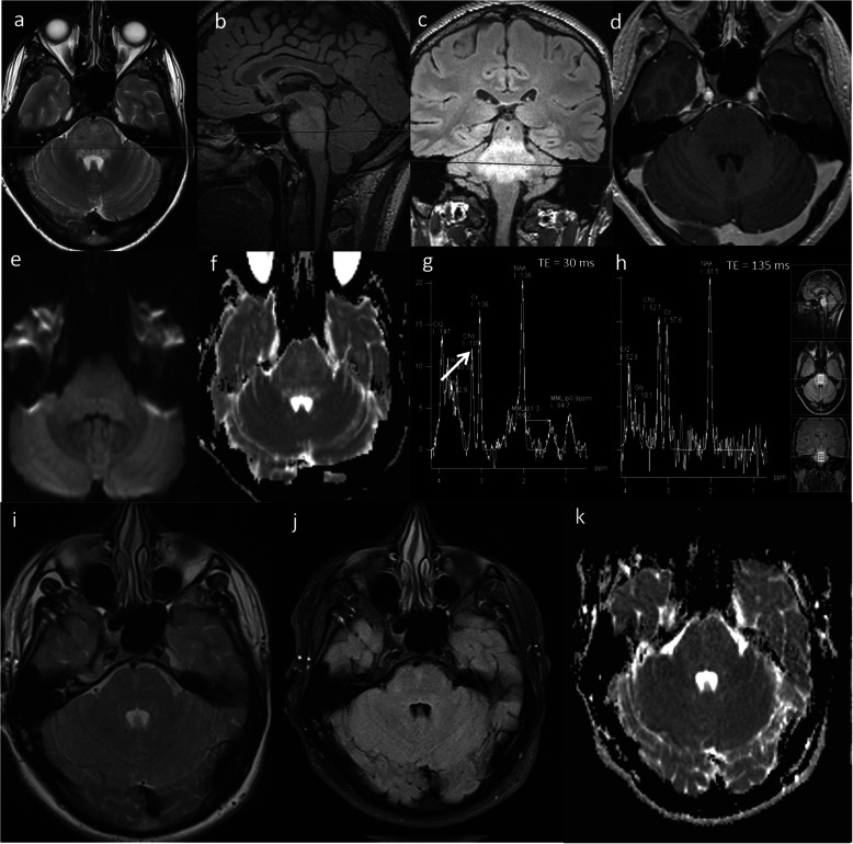 Fig. 15