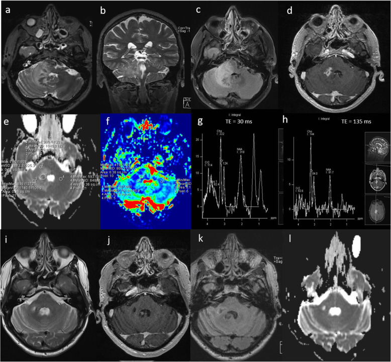 Fig. 14