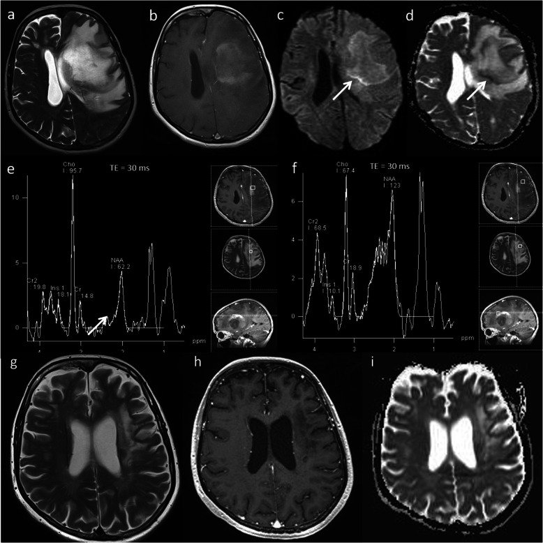 Fig. 16