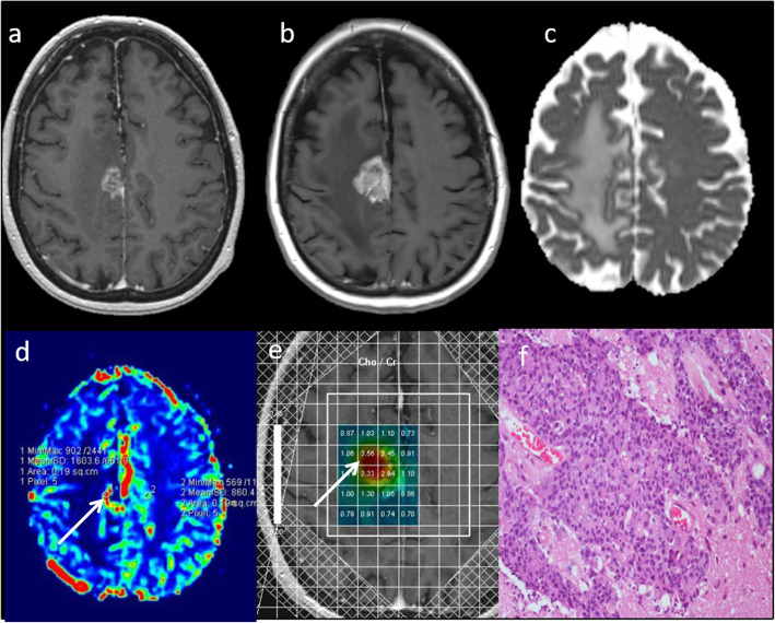 Fig. 11