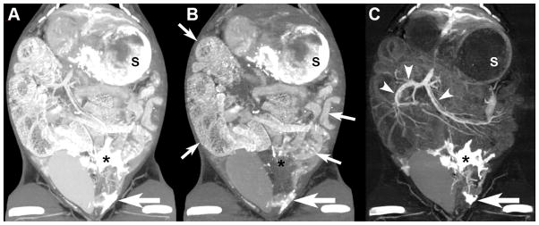 Fig. 10