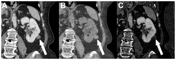 Fig. 9