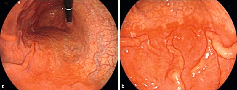 Fig. 2