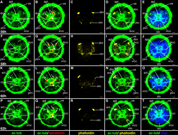 Figure 20