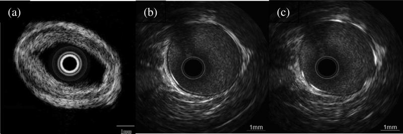 Fig. 21